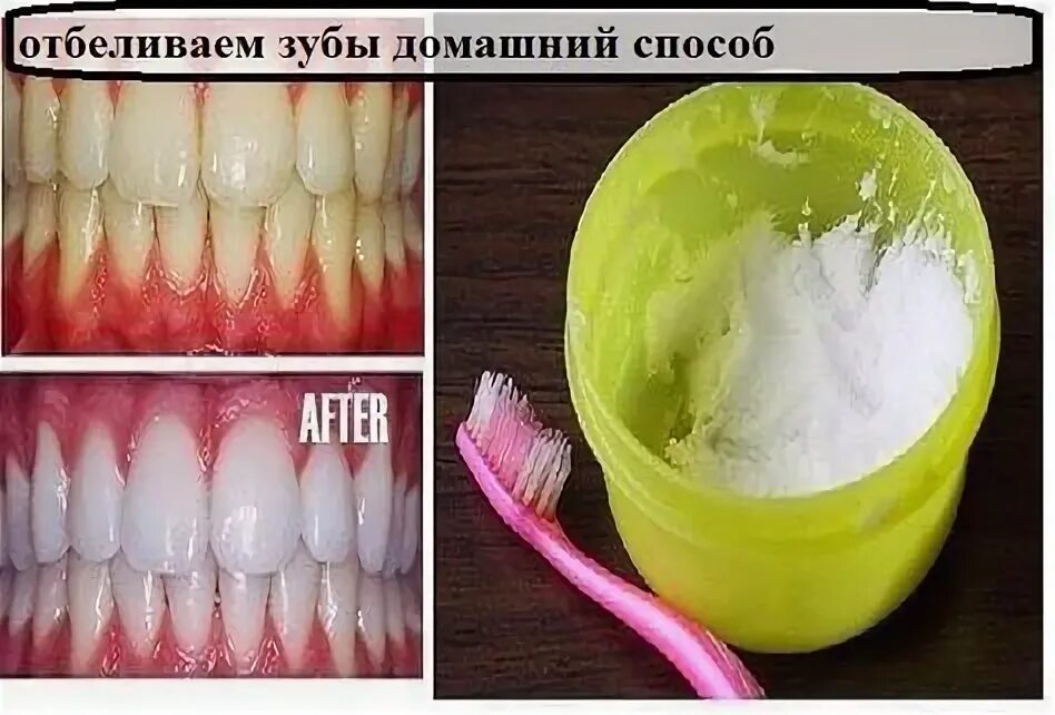 Домашний рецепт как отбелить зубы. Домашний рецепт как отбелить зубы