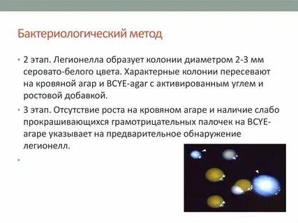 Бактериологический метод исследует
