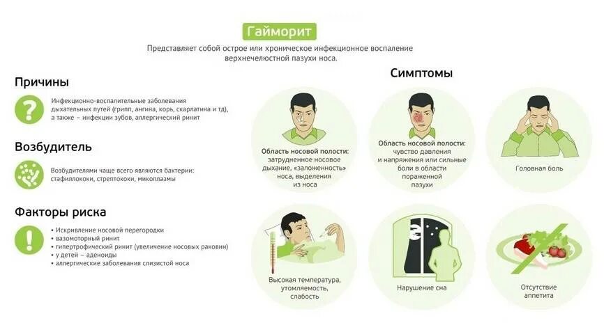 Синусит признаки лечение у взрослых