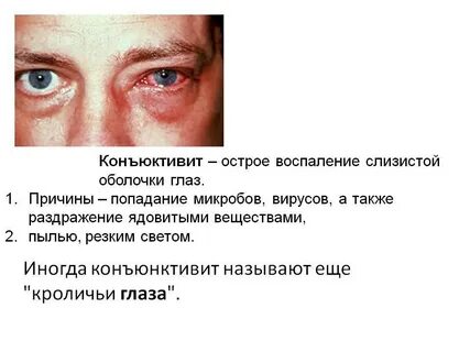 Можно ли в баню при конъюнктивите