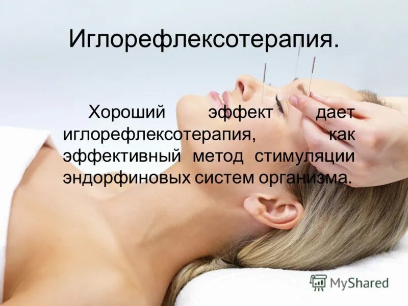 китайская медицина иглоукалывание. иглоукалывание точки при остеохондрозе шейного. иглорефлексотерапия при остеохондрозе. иглорефлексотерапия при остеохондрозе шейного отдела. рефлексотерапия показания.