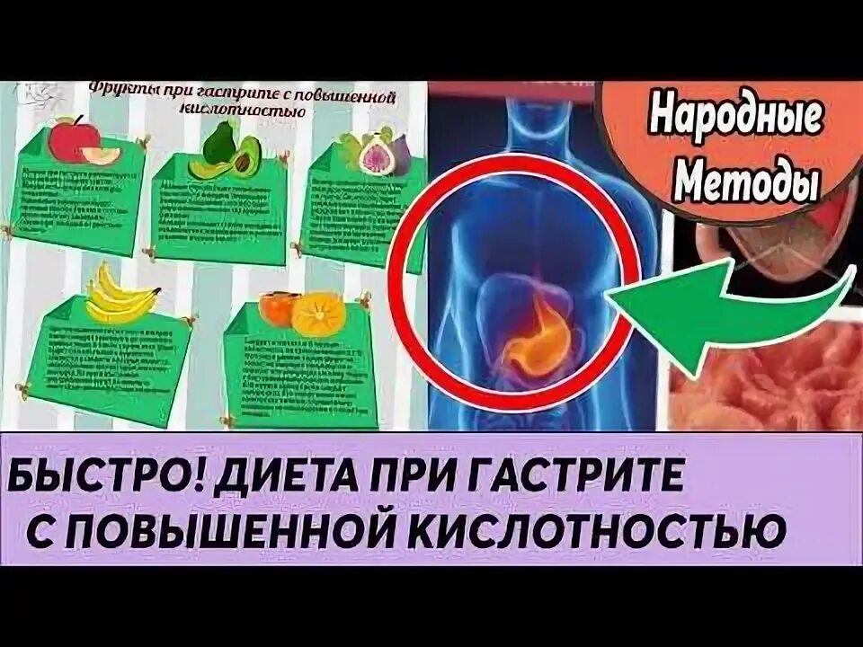 Диета при гастрите с повышенной кислотностью. Повышенная кислотность диета. Повышенная кислотность желудка диета. Гастрит повышенная кислотность диета.