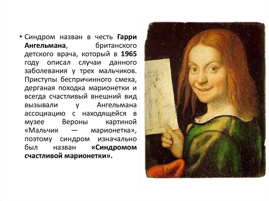 Синдром ангельмана сын. Синдром ангельмана клинические проявления. синдром ангельмана внешние проявления. синдром ангельмана у детей.