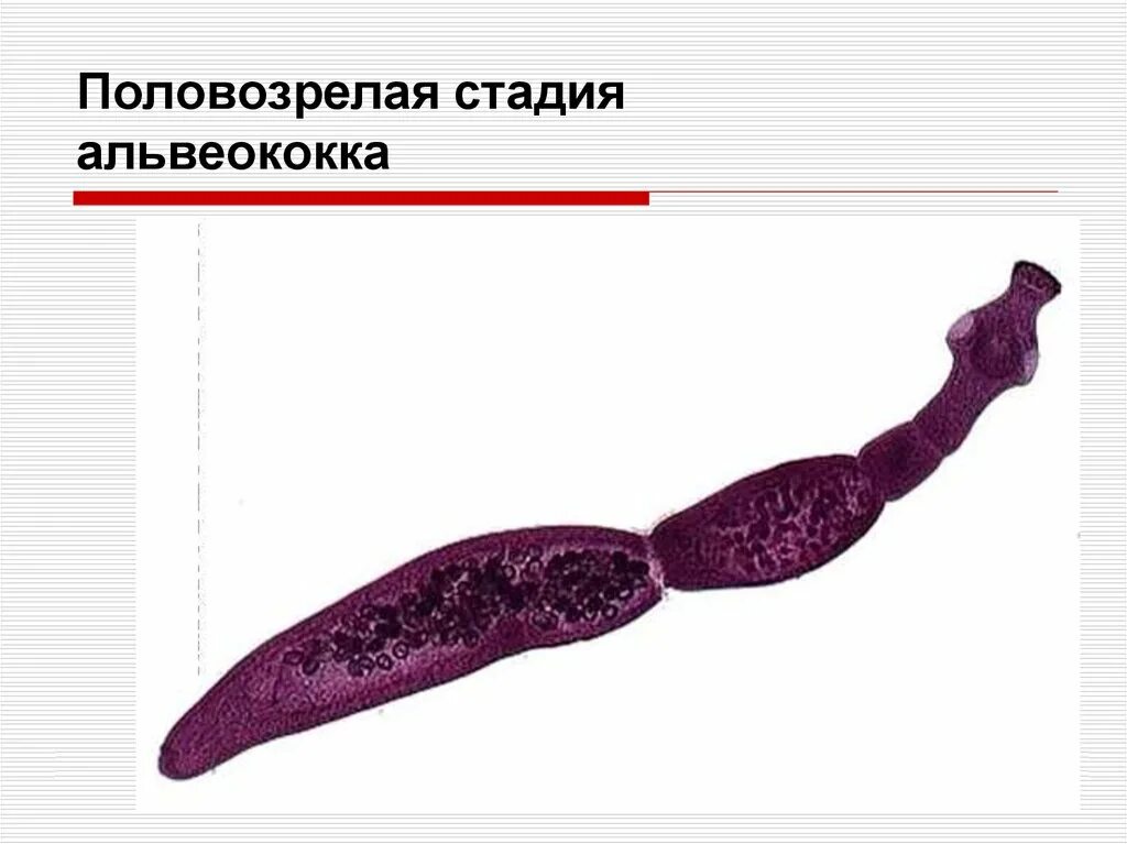 Альвеококкоз и эхинококкоз. Альвеококкоз и эхинококкоз. Паразиты эхинококкоз. Финна эхинококка микроскоп. Эхинококкоз форма и размер.