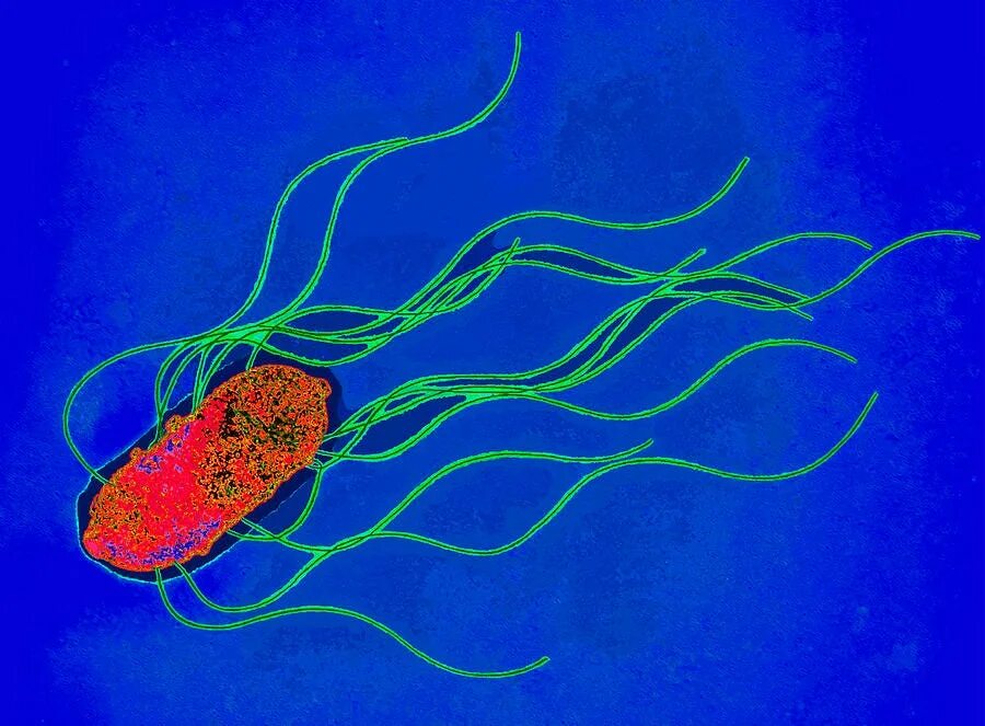 Salmonella enterica. Сальмонелла Бангоре. Сальмонелла — бацилла. Сальмонелла энтерика. Сальмонеллез возбудитель.