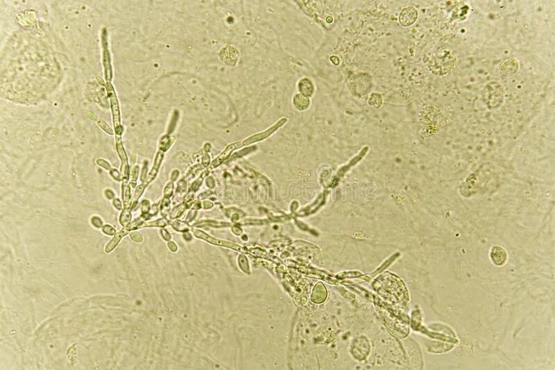 Дрожжевые клетки в моче повышены. Мицелий грибов в моче микроскопия. Грибы кандида микроскопия. Грибы кандида лептотрикс.