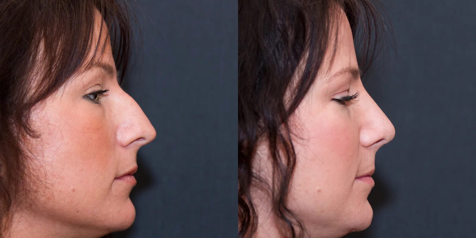 Греческий профиль нос с горбинкой. Женщина с длинным носом. Нос с горбинкой нос курносый. Длинный нос у девушки. Курносый нос с горбинкой.