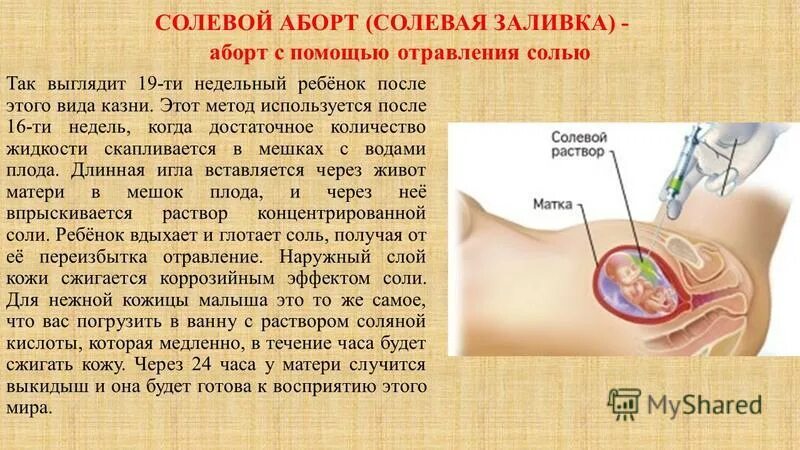 Антибиотик после прерывания беременности. Гормональные контрацептивы после аборта. Таблетки миропристон 200 мг. Мифепристон таблетки для прерывания. Методы искусственного прерывания беременности.