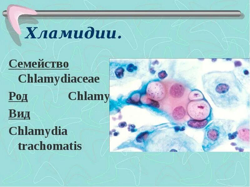 Anti chlamydia trachomatis. Хламидия трахоматис вид род семейство. Хламидии семейство род вид.