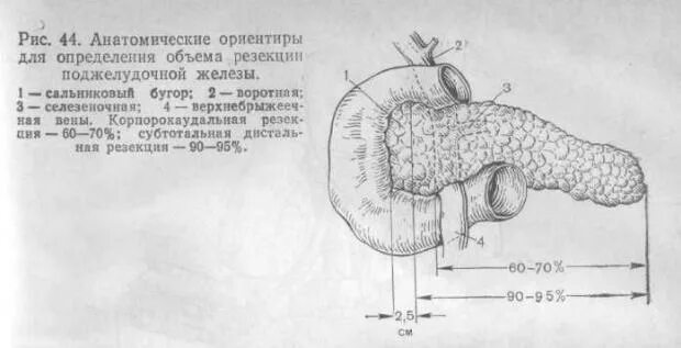 Парапанкреатическая клетчатка что это значит