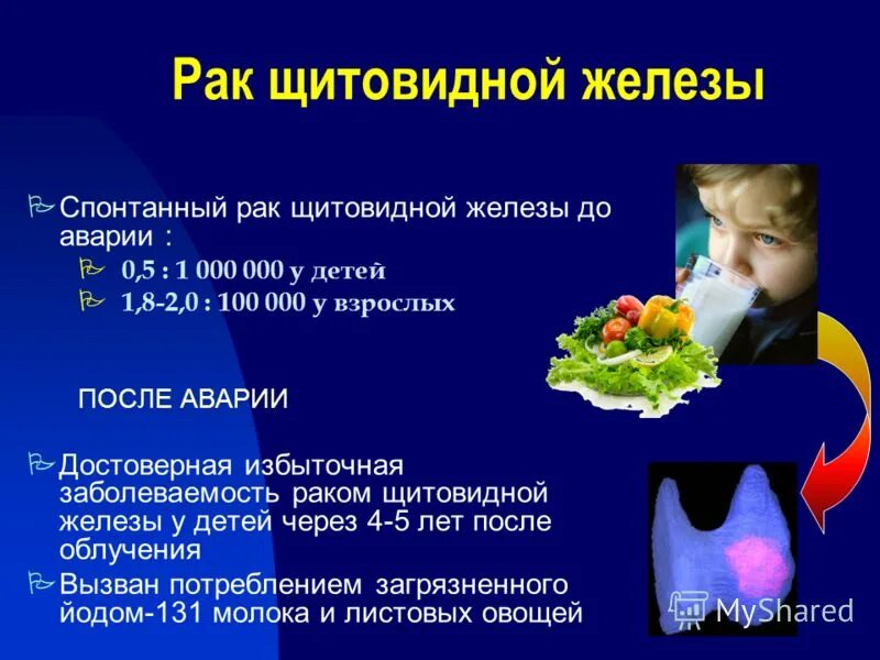 клиническая картина дтз. щитовидная железа у детей. гипертиреоз у детей симптомы. увеличенная щитовидная железа. гипертиреоз щитовидной железы симптомы у детей.