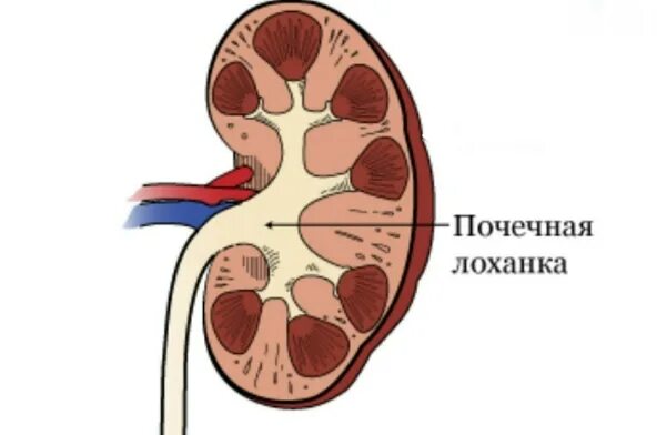 Собирается в почечную лоханку. Почечная лоханка. Лоханка мочевого пузыря. Почечная лоханка и мочеточник. Что такое лоханка почки у взрослого человека фото.