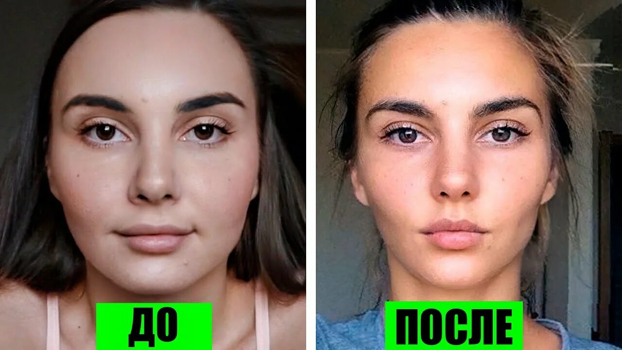 Лицо 7 что делать. Худое лицо до и после. лицо до и после похудения. щеки до и после похудения. похудение лица до скул.