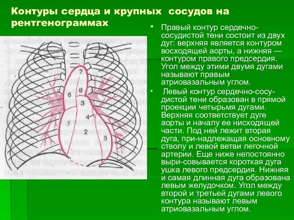 Дуги сердца в прямой проекции. Правый контур сердца в норме. Прямая проекция сердца. Проекции сердца на рентгенограмме. Удлинена дуга