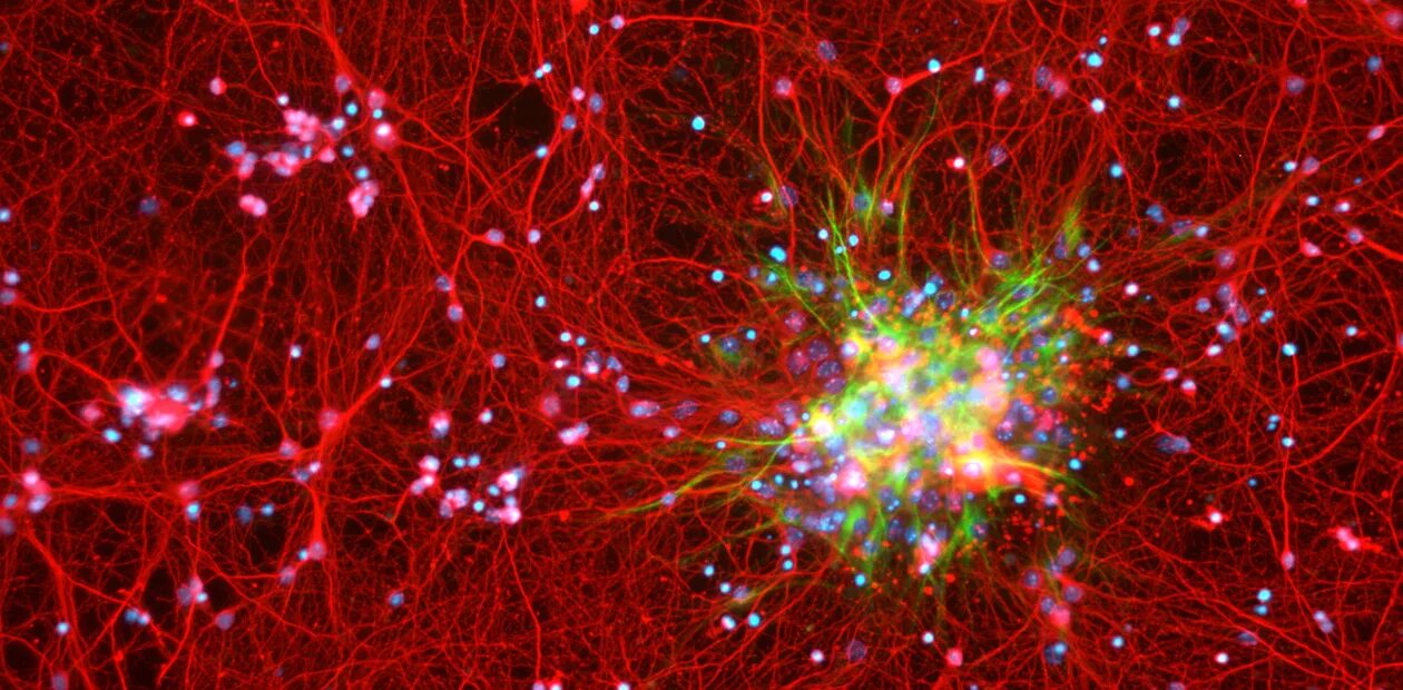 Нейронные связи в мозге. Клетки вселенные. Клетка человека и Вселенная. Умершие клетки мозга