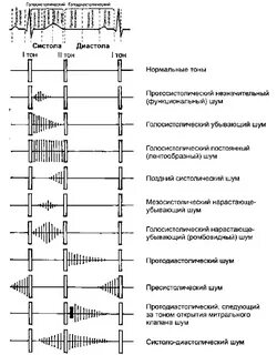 Шумы в работающей системе