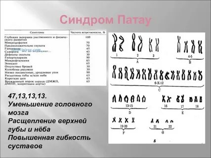 Кариотип больного с синдромом патау