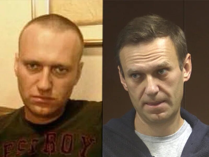 Сколько лет было навальному на момент. Навальный лысый. Лысый Навальный 2021.
