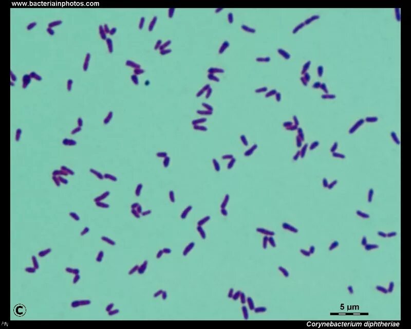 Mobiluncus spp corynebacterium в мазке. Коринебактерии дифтерии. коринебактерии дифтерии микробиология. corynebacterium diphtheriae микроскопия. коринебактерии микробиология.