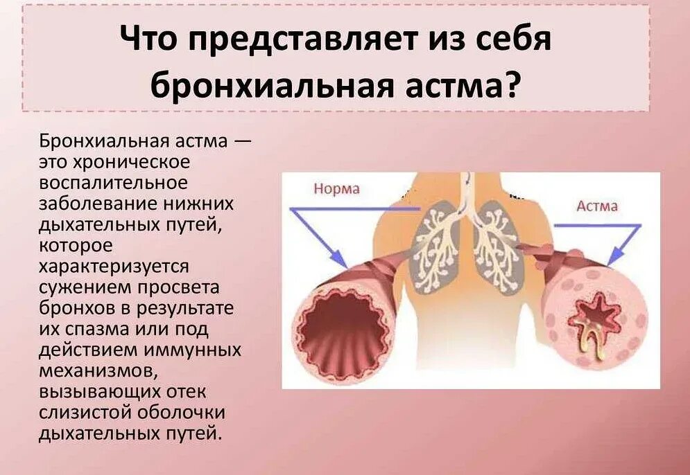 Раздражение при вдохе