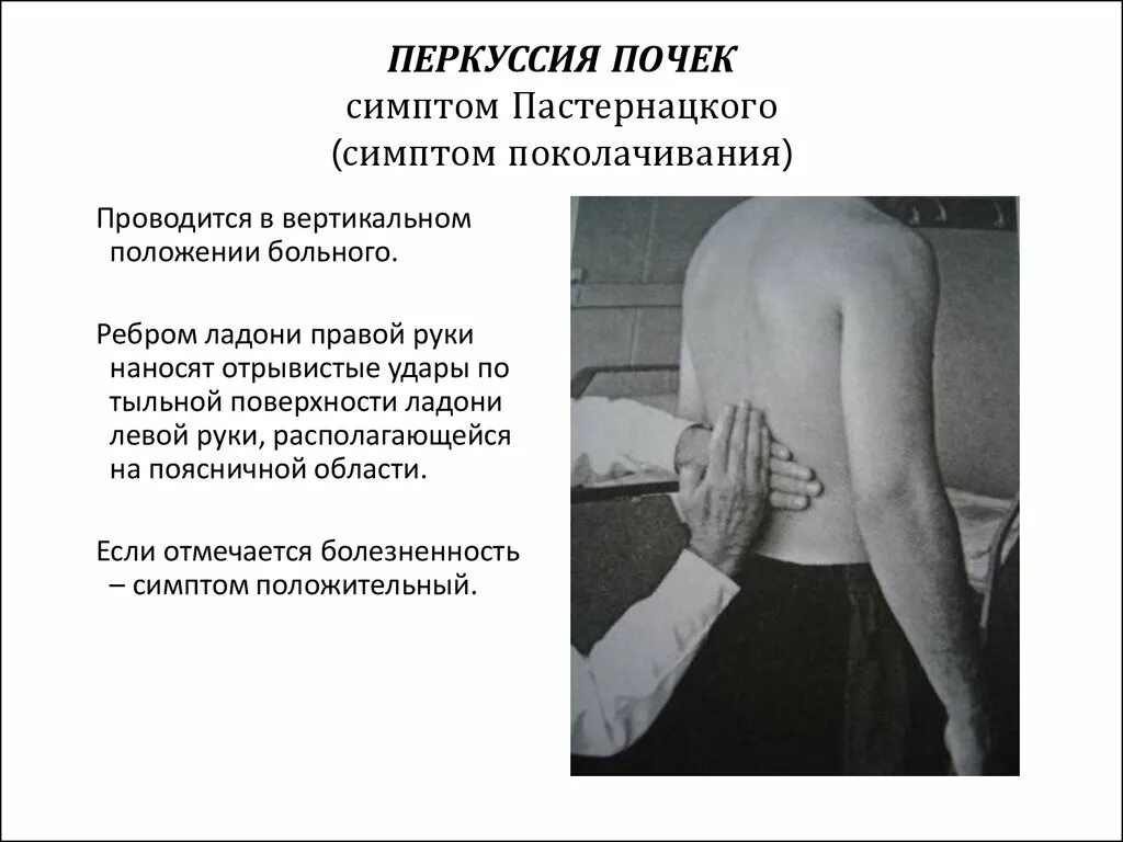 Что такое симптом. Бимануальная пальпация почек. методика проведения симптома пастернацкого. пальпация почек симптом пастернацкого. перкуссия почек метод пастернацкого.