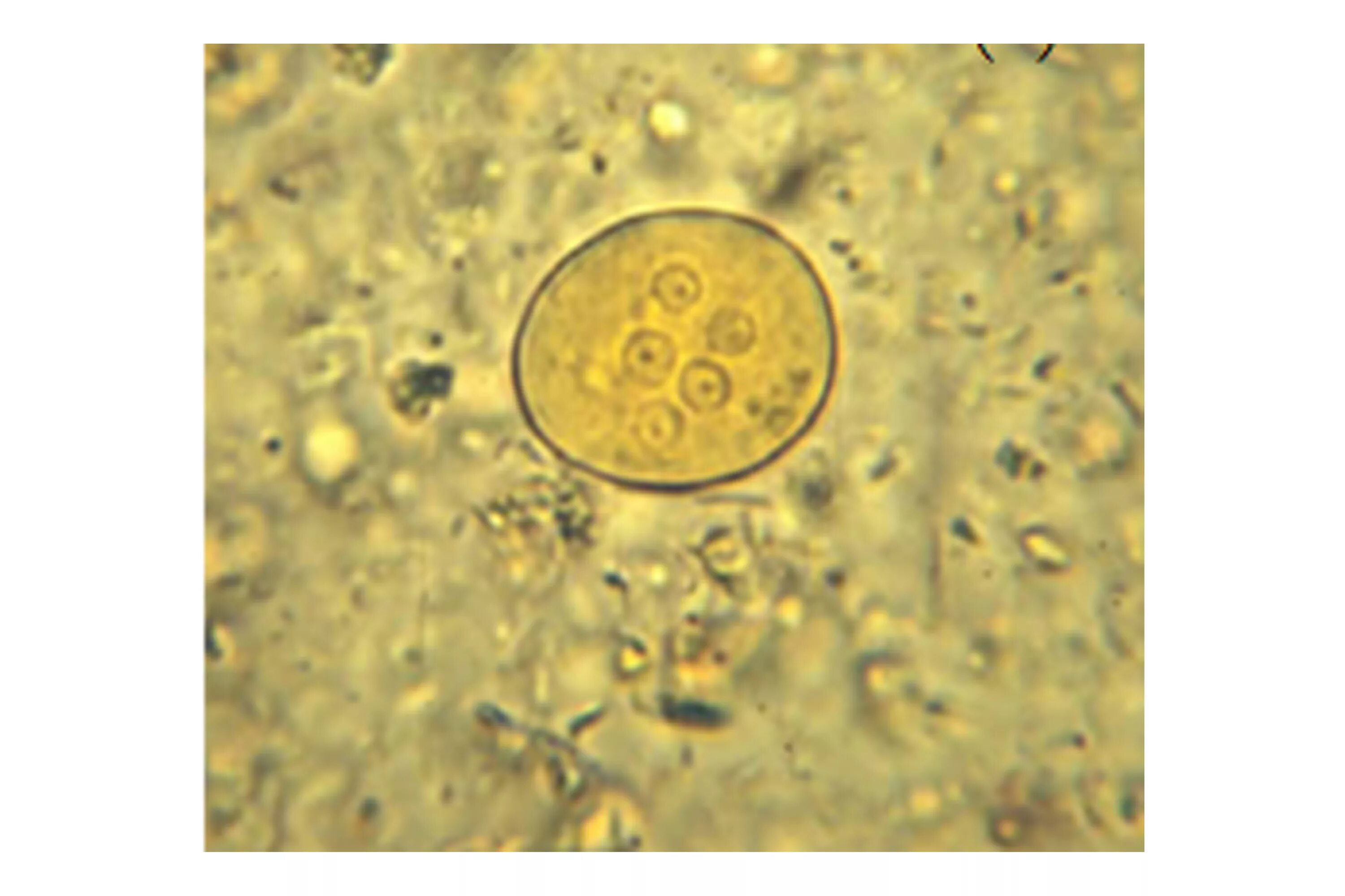 Цисты Endolimax Nana. Entamoeba histolytica. Entamoeba histolytica микроскопия. Entamoeba dispar цисты. Entamoeba coli в кале