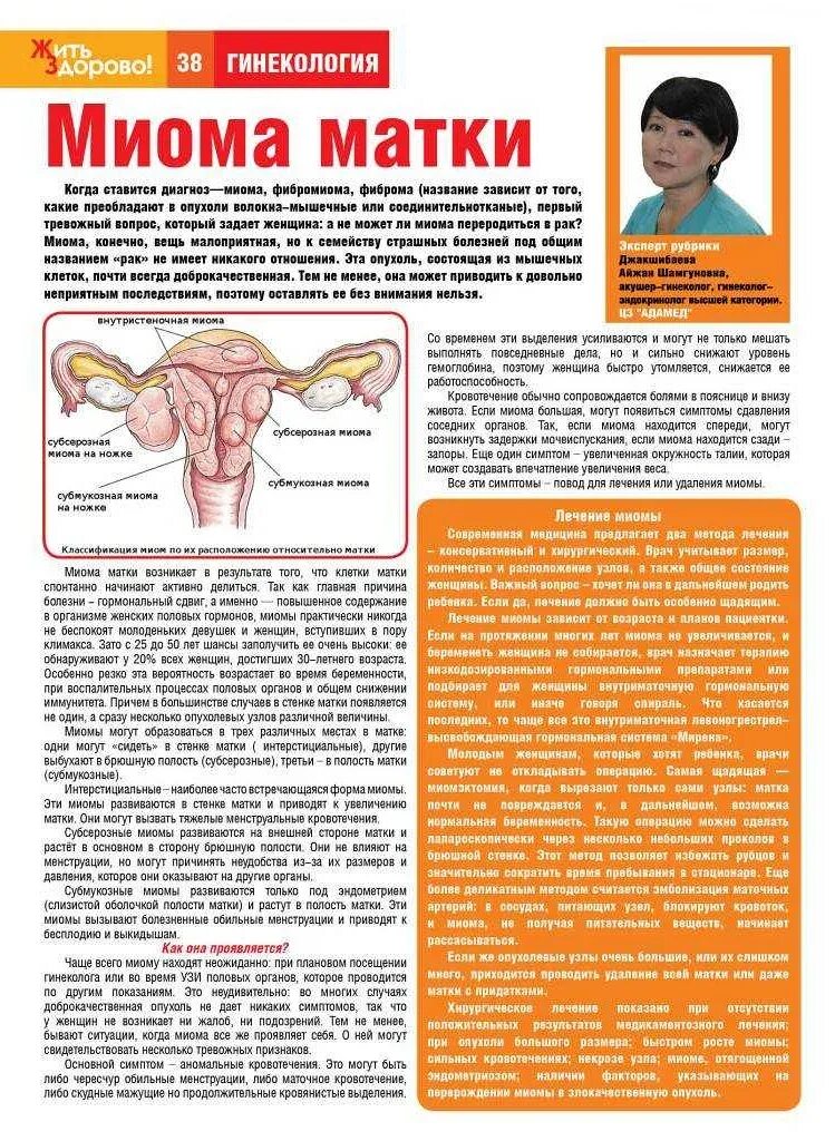Можно ли удалить миому матки. Памятка на тему миома матки. санбюллетень миома матки.