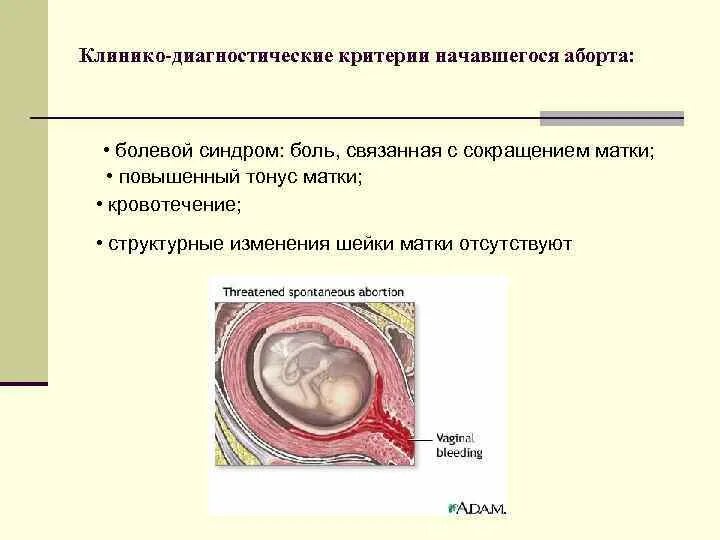 Гипертонус Матки Можно Заниматься Сексом