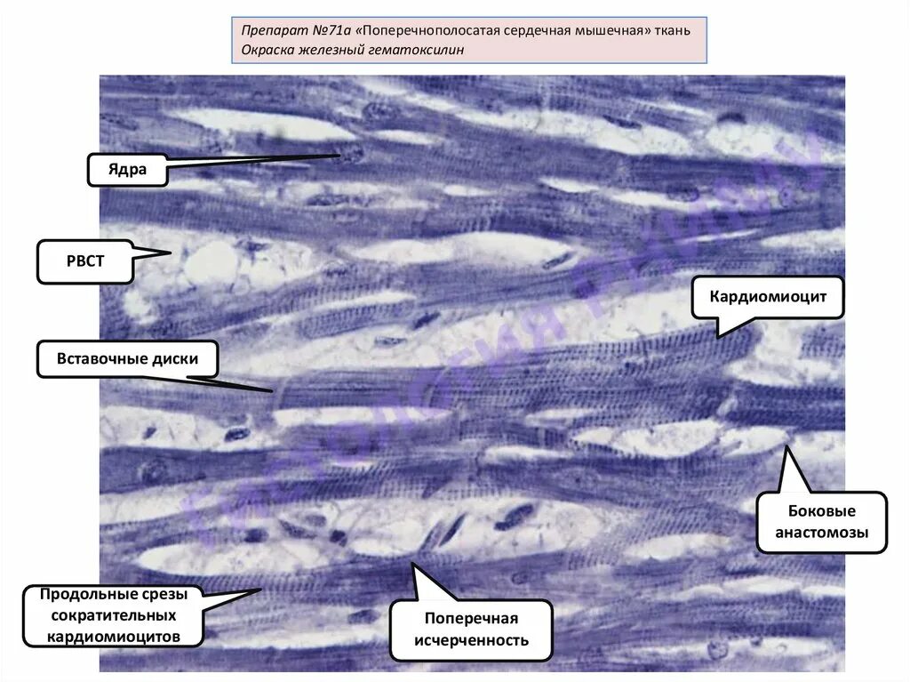 Сердечная мышечная ткань окраска Железный гематоксилин. Препарат сердечная мышечная ткань Железный гематоксилин. Поперечнополосатая сердечная мышечная ткань препарат. Поперечнополосатая сердечная мышечная ткань гистология. Препарат поперечно полосатая мышечная ткань