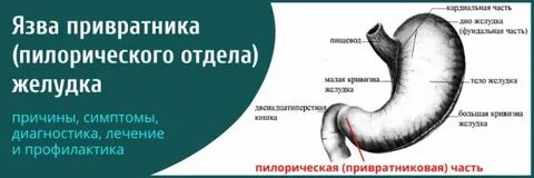 Антральный отдел привратника