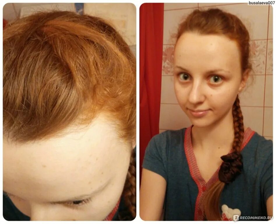 Рост волос после химиотерапии. Хна на русые волосы до и после. Окрашивание волос хной до и после. Окрашивание хной на осветление волосы. Русая хна до и после.