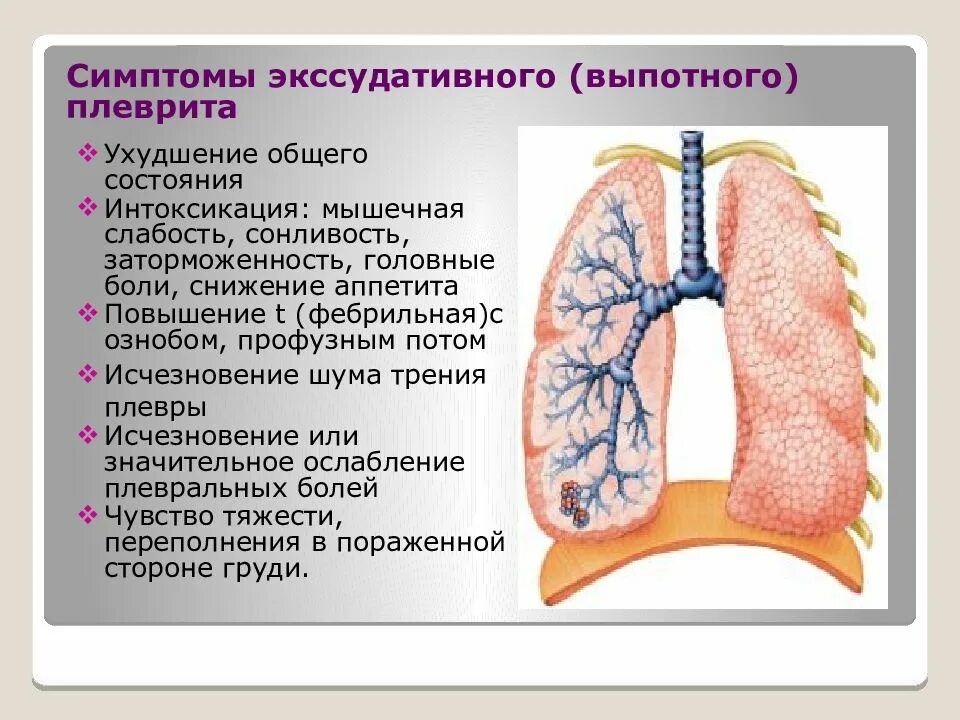 Экссудативный плеврит. Выпотной плеврит симптомы.