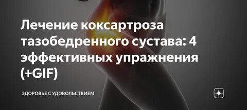 Коксартроз увт
