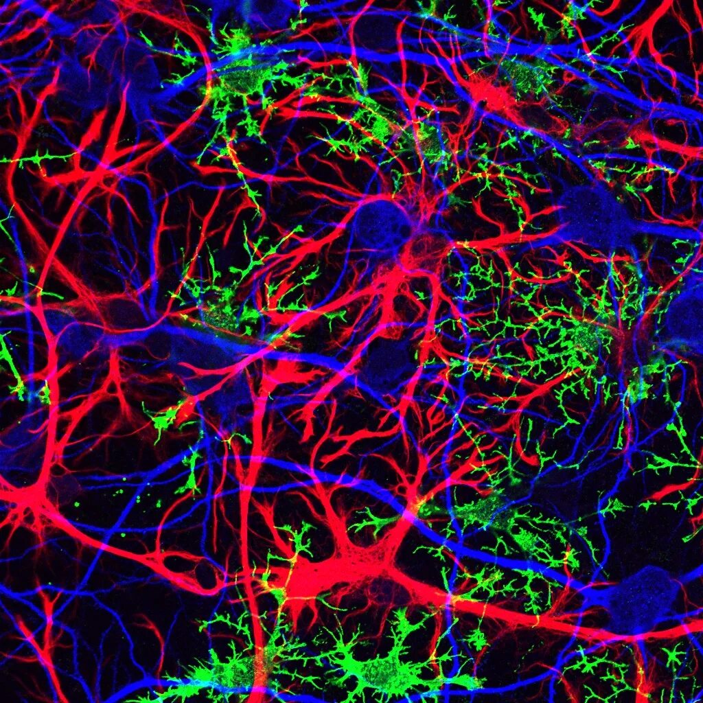 Клетки головного мозга астроциты. Нейроны мозга. Нейронная клетка. Нейронные связи головного мозга.