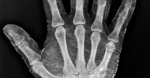 Жыныстық жылжымалы аққұбалар