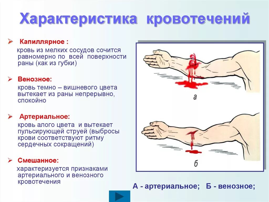 Почему происходит кровотечение. Особенности капиллярного кровотечения. Характеристика капиллярного кровотечения. Артериальное венозное и капиллярное кровотечение. Характеристика венозного и артериального кровотечения.