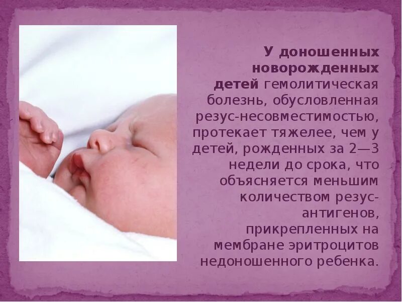 Заболевания новорожденности. Болезни новорожденных. Дети с гемолитической болезнью. Гемолитическая болезнь новорожденного. Гемолитическая болезнь новорожденных дети.