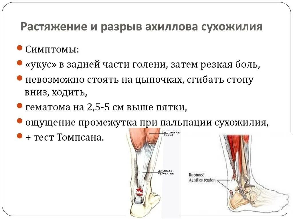 Травмы мышц и сухожилий. Симптоматика повреждения ахиллова сухожилия. Разрыв ахиллова сухожилия ахиллова. Иннервация ахиллова сухожилия. Разрыв ахиллова сухожилия симптомы.