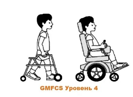 Уровни дцп