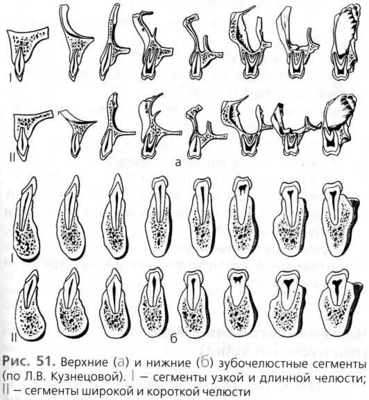 Зубочелюстные сегменты. Зубочелюстной сегмент анатомия. зубочелюстные сегменты верхней и нижней челюсти. зубочелюстные сегменты верхней челюсти. зубочелюстной сегменты верхней и нижней челюсти анатомия.