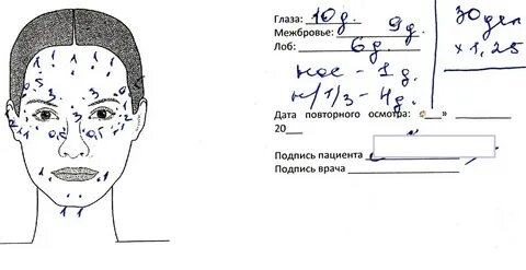 Схема диспорта