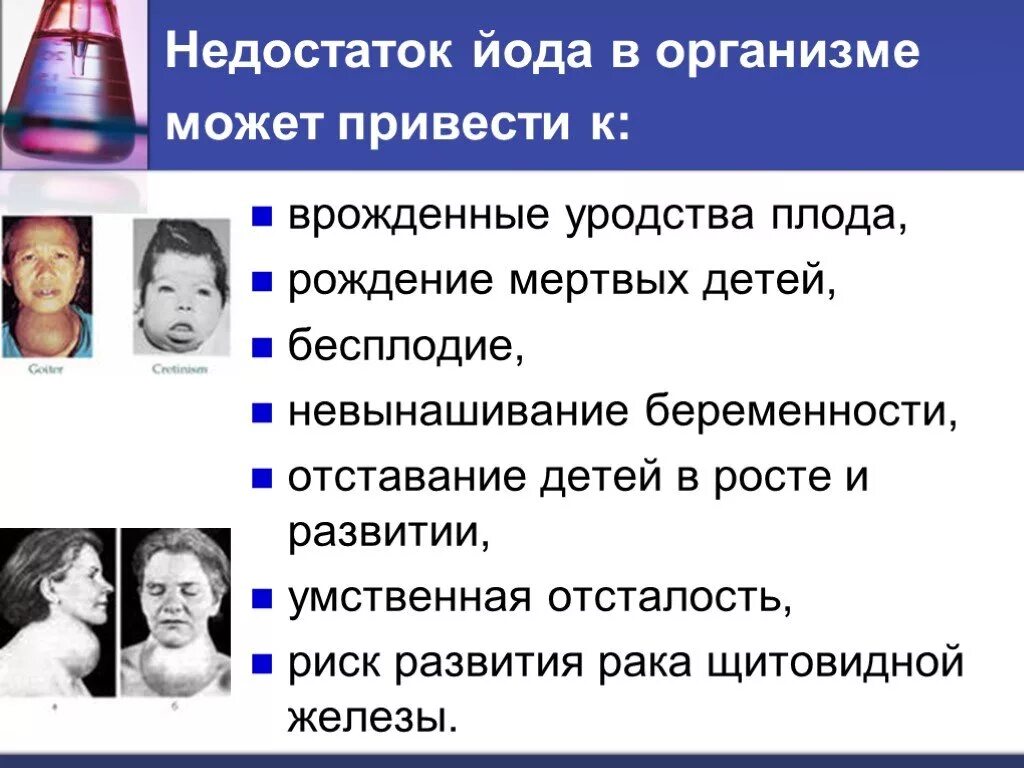 Недостаток йода заболевание