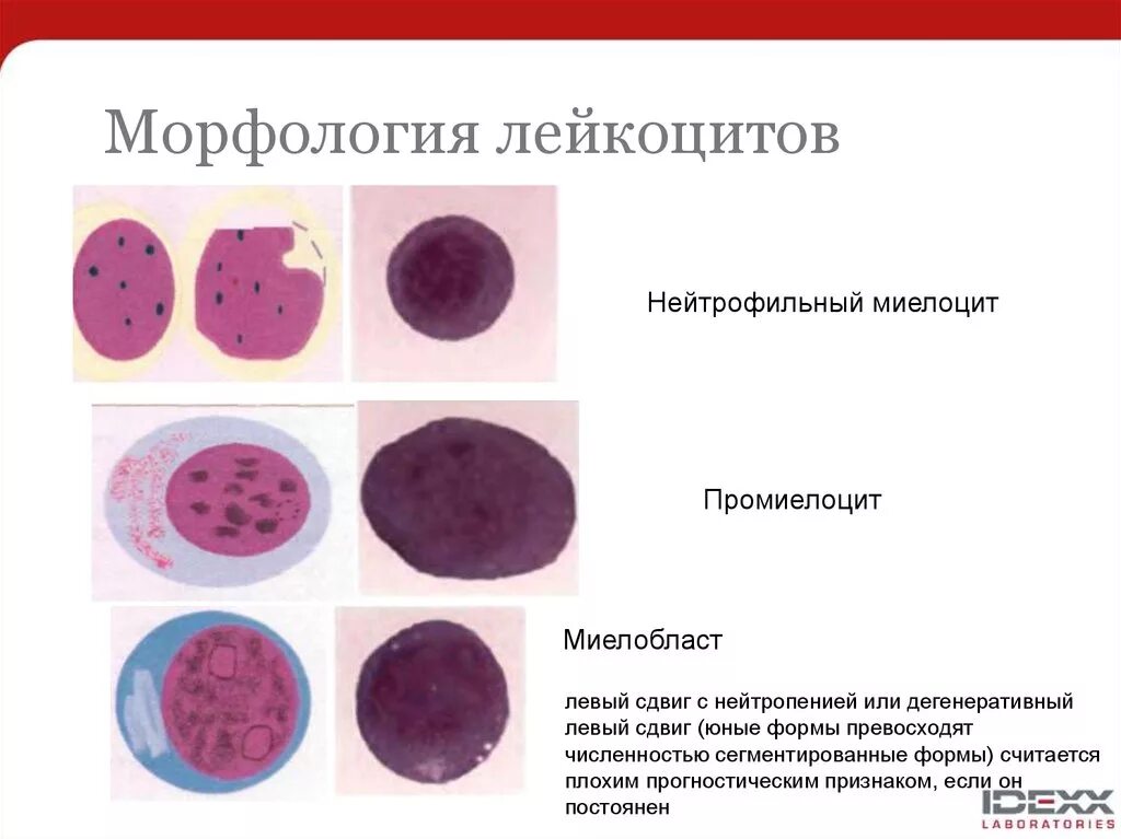 Патология лейкоцитов. Палочкоядерные нейтрофилы морфология. Морфология сегментоядерного лейкоцита. Морфология палочкоядерных нейтрофилов. Зернистые лейкоциты нейтрофилы строение.