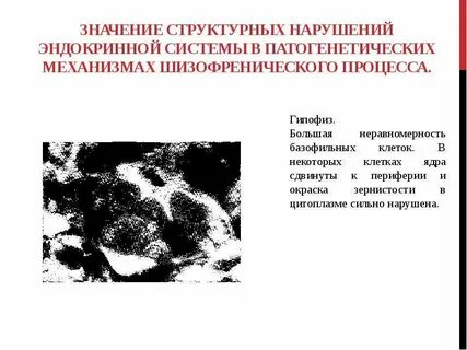 Структурные нарушения