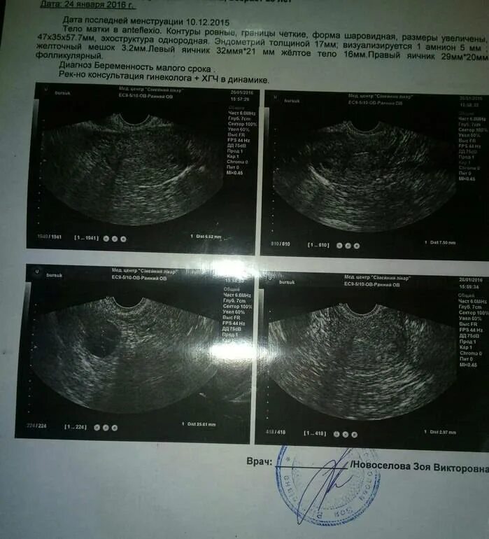 Матка в мм при беременности. Жёлтое тело диаметром 5 мм. УЗИ беременности 5 недель эндометрий. УЗИ 4 недели беременности желтое тело.