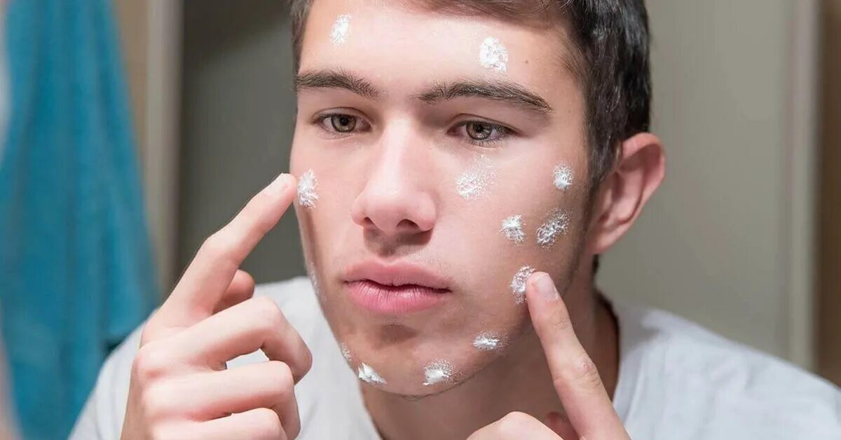 Problem skin