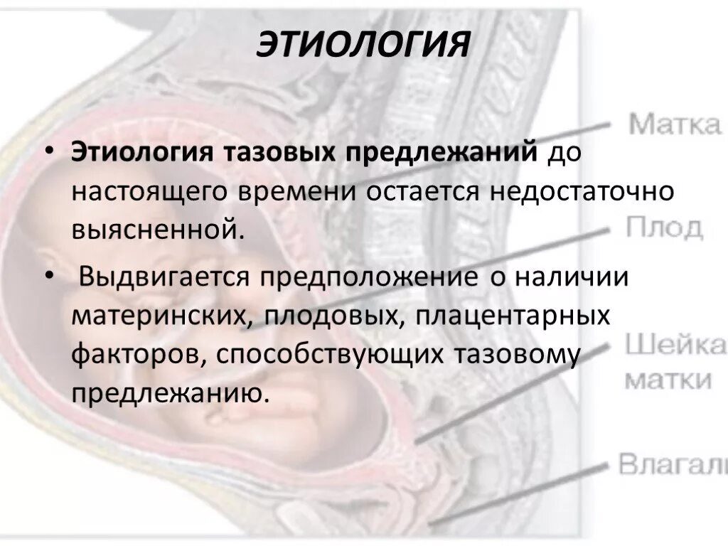 Осложнения тазового предлежания. Этиология тазового предлежания. Этиология тазового предлежания плода. Осложнения тазового предлежания плода. Причины тазового предлежания плода.