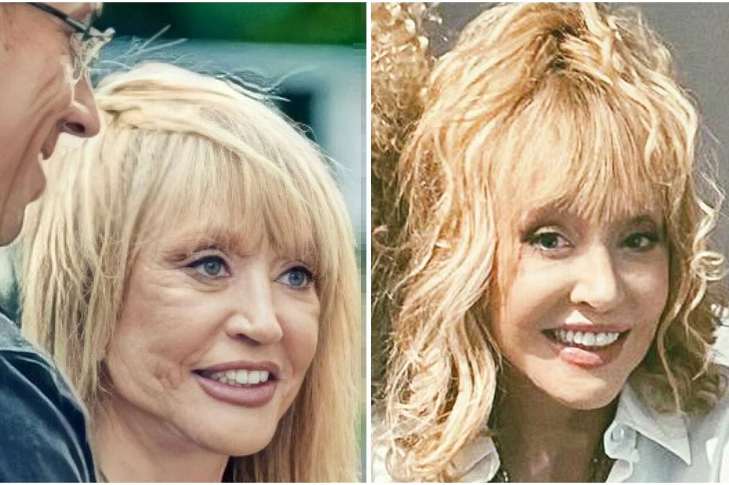 Пугачева после. Пугачева после. Пугачева сейчас фото 2023. Пугачева после. Пугачева пластика 2022.