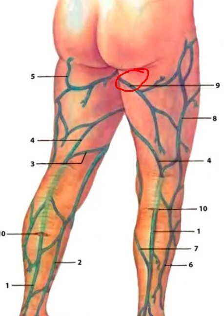 Лимфоузлы на ногах где. Малая подкожная Вена (v. saphena Parva). Подколенные лимфоузлы. Подколенная Вена варикоз.