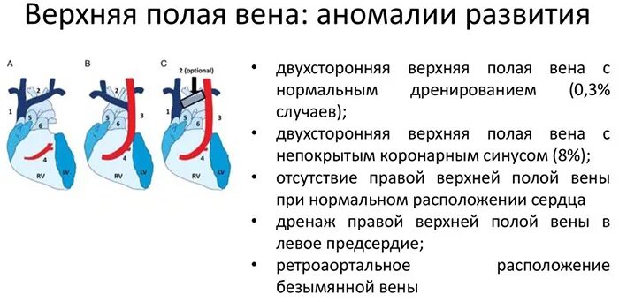 Две верхние полые вены. Добавочная левая верхняя полая Вена. Аномалии верхней полой вены. Аномалии развития нижней полой вены. Формирование верхней полой вены.